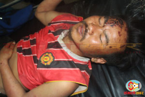 आँखिसल्लामा कुटपिटबाट एक युवा गंभीर घाईते, घाईतेको अवस्था चिन्ताजनक