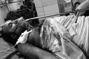 बिराटनगरमा शौच गर्न बाहिर निस्किदा आचार्य श्रीनिवासमाथि गोली प्रहार