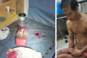 ब्लु फिल्म हेरिरहेका युवकले उत्तेजित भएर आफ्नो गुप्तांग नै काटे