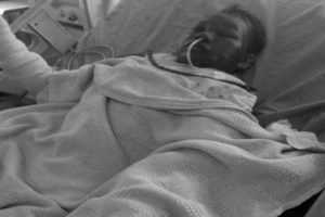 तेजाब आक्रमणबाट घाइते सम्झनाको मृत्यु