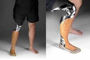 कृत्रिम खुट्टा वितरण