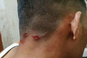 चितुवाको आक्रमणबाट प्रहरी घाइते