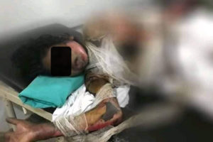 सिरहामा महिलालाई जिउँदै जलाईयो, बुहारीलाई आगो लगाउँने सासु पक्राउ, श्रीमान फरार