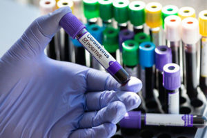 थपिए ३३१ कोरोना संक्रमित