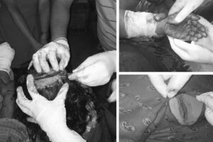 संखुवासभामा श्रीमतीमाथि अन्धाधुन्ध खुकुरी प्रहार