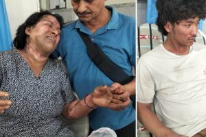 विराटनगरको जतुवामा ग्यास सिलिन्डर विस्फोट हुँदा आमा-छोरा घाइते