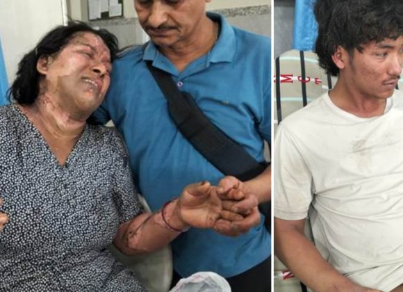 विराटनगरमा पेट्रोल छर्किएर महिलाले शरीरमा आगो लगाइन्, सिलिन्डर विस्फोट भएको भन्दै ढाँटियो