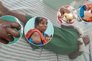 आफ्नै जग्गामा धान रोप्न नपाएकी वृद्धामाथि देवर र भतिजाहरूद्वारा निर्घात कुटपिट