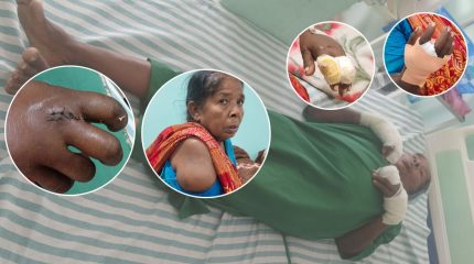 आफ्नै जग्गामा धान रोप्न नपाएकी वृद्धामाथि देवर र भतिजाहरूद्वारा निर्घात कुटपिट