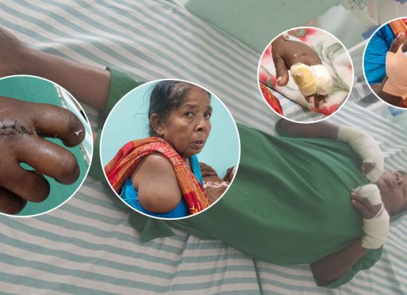 आफ्नै जग्गामा धान रोप्न नपाएकी वृद्धामाथि देवर र भतिजाहरूद्वारा निर्घात कुटपिट