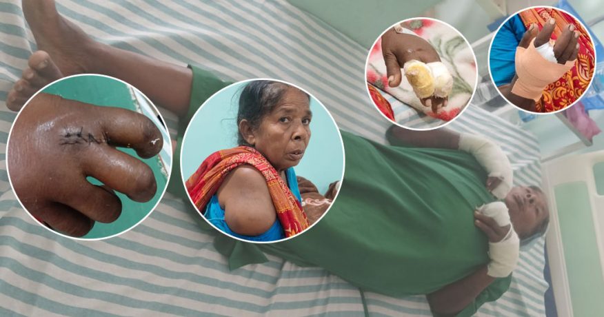 आफ्नै जग्गामा धान रोप्न नपाएकी वृद्धामाथि देवर र भतिजाहरूद्वारा निर्घात कुटपिट
