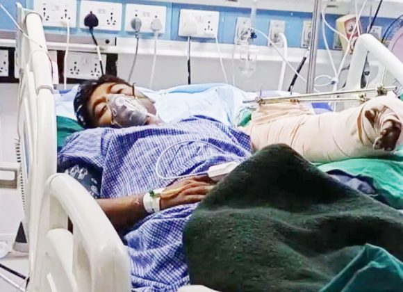 कप्तानगन्ज झडपमा गोली लागेर घाइते भएका अमितको काटियो हात