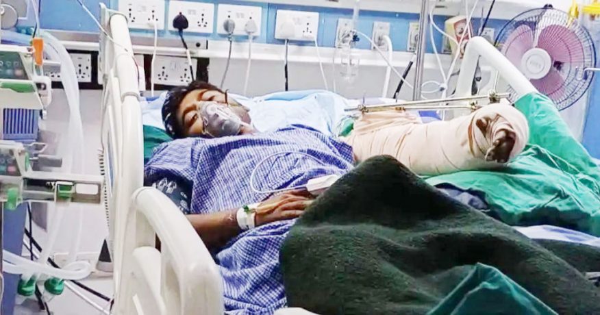 कप्तानगन्ज झडपमा गोली लागेर घाइते भएका अमितको काटियो हात