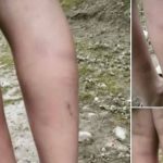पाँचथरको सिंहदेवी विद्यालयमा अध्ययनरत बालकमाथि गृहकार्य नगरेको भन्दै कुटपिट