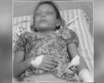 इटहरीमा सर्पले डसेकी बालिकाको अस्पताल डुलाउँदा डुलाउँदै मृत्यु