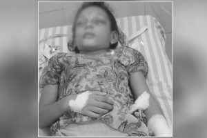 इटहरीमा सर्पले डसेकी बालिकाको अस्पताल डुलाउँदा डुलाउँदै मृत्यु