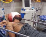 दुर्घटनामा गम्भीर घाइते उदयपुरका बरदानको उपचारका लागि सहयोगको अपिल