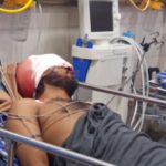 दुर्घटनामा गम्भीर घाइते उदयपुरका बरदानको उपचारका लागि सहयोगको अपिल